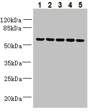Western blot - Anti-ADAT1 antibody (AB235341)