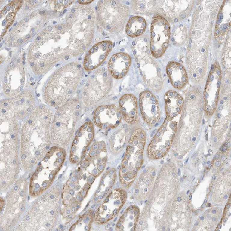 Immunohistochemistry (Formalin/PFA-fixed paraffin-embedded sections) - Anti-ADAT2 antibody (AB122280)
