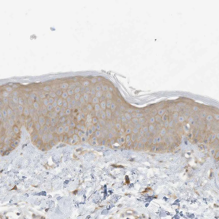 Immunohistochemistry (Formalin/PFA-fixed paraffin-embedded sections) - Anti-ADAT2 antibody (AB122280)