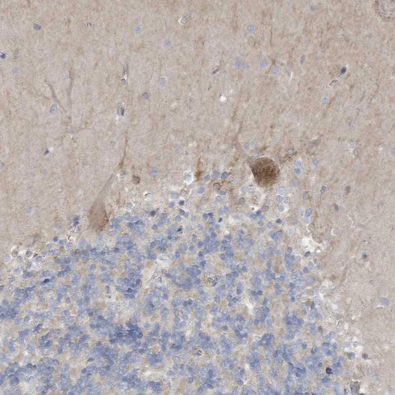 Immunohistochemistry (Formalin/PFA-fixed paraffin-embedded sections) - Anti-ADAT2 antibody (AB122280)