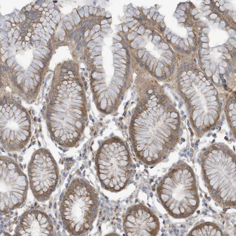 Immunohistochemistry (Formalin/PFA-fixed paraffin-embedded sections) - Anti-ADAT2 antibody (AB122280)
