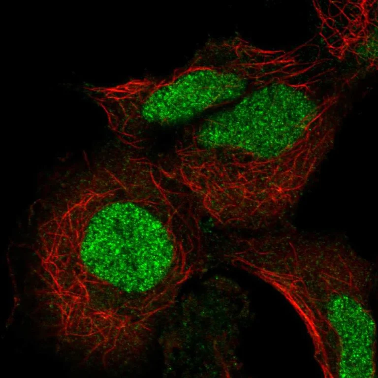 Immunocytochemistry/ Immunofluorescence - Anti-ADAT3 antibody (AB247133)