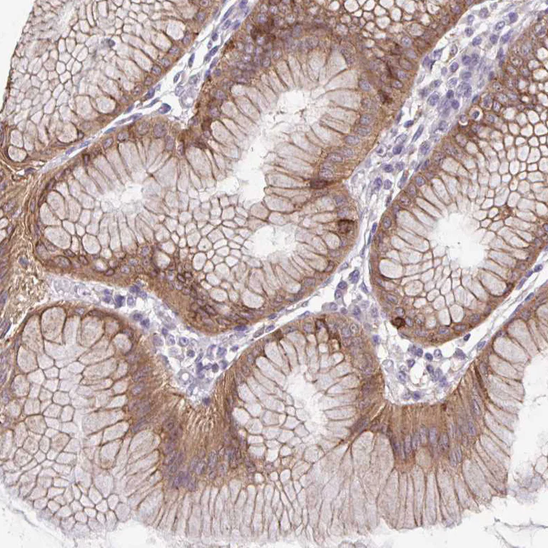 Immunohistochemistry (Formalin/PFA-fixed paraffin-embedded sections) - Anti-ADAT3 antibody (AB247133)