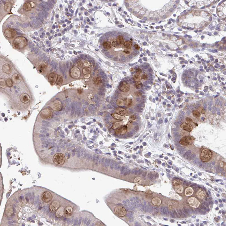 Immunohistochemistry (Formalin/PFA-fixed paraffin-embedded sections) - Anti-ADAT3 antibody (AB247133)