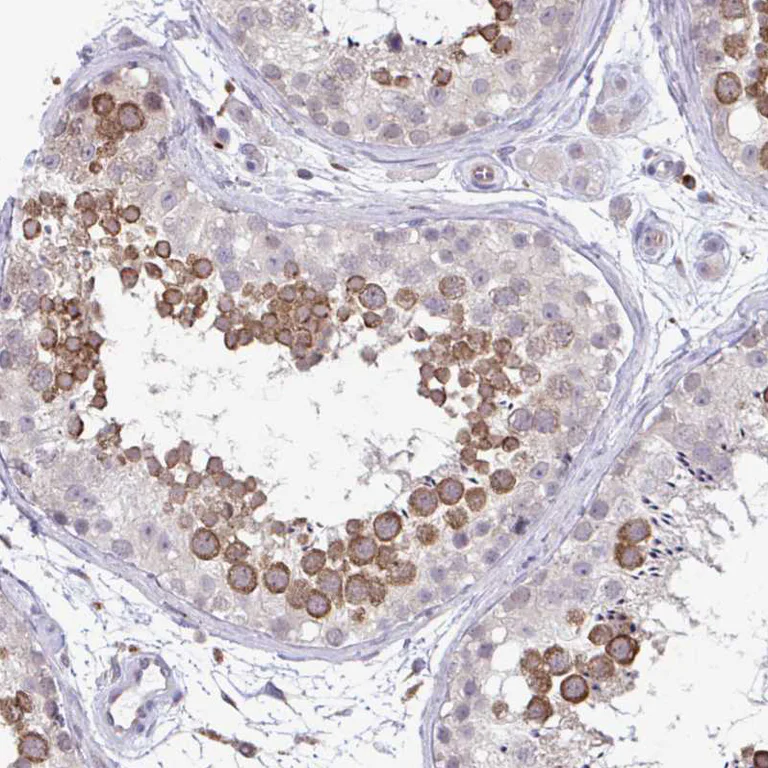 Immunohistochemistry (Formalin/PFA-fixed paraffin-embedded sections) - Anti-ADAT3 antibody (AB247133)