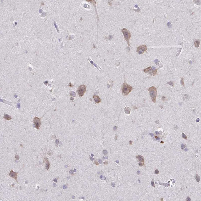 Immunohistochemistry (Formalin/PFA-fixed paraffin-embedded sections) - Anti-ADAT3 antibody (AB247133)