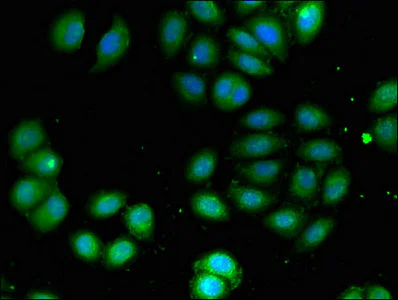 Immunocytochemistry/ Immunofluorescence - Anti-ADCK4 antibody (AB223114)