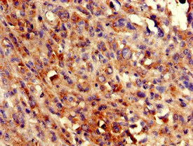 Immunohistochemistry (Formalin/PFA-fixed paraffin-embedded sections) - Anti-ADCK4 antibody (AB223114)