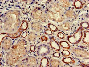 Immunohistochemistry (Formalin/PFA-fixed paraffin-embedded sections) - Anti-ADCK4 antibody (AB223114)