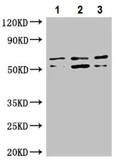 Western blot - Anti-ADCK4 antibody (AB223114)
