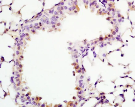 Immunohistochemistry (Formalin/PFA-fixed paraffin-embedded sections) - Anti-ADCY10/SAC antibody (AB203204)