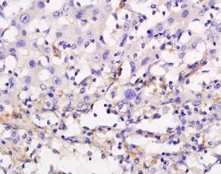 Immunohistochemistry (Formalin/PFA-fixed paraffin-embedded sections) - Anti-ADCY10/SAC antibody (AB203204)