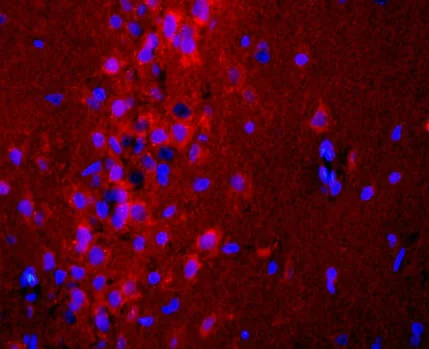 Immunohistochemistry (Formalin/PFA-fixed paraffin-embedded sections) - Anti-ADCY10/SAC antibody (AB203204)