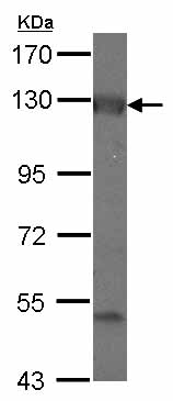 Western blot - Anti-ADCY2 antibody (AB127019), expandable thumbnail