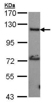 Western blot - Anti-ADCY2 antibody (AB151470)
