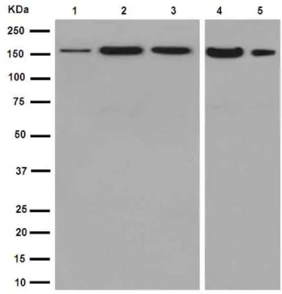 Anti-ADCY9/AC9 antibody [EPR16188] - BSA and Azide free (ab251076) | Abcam