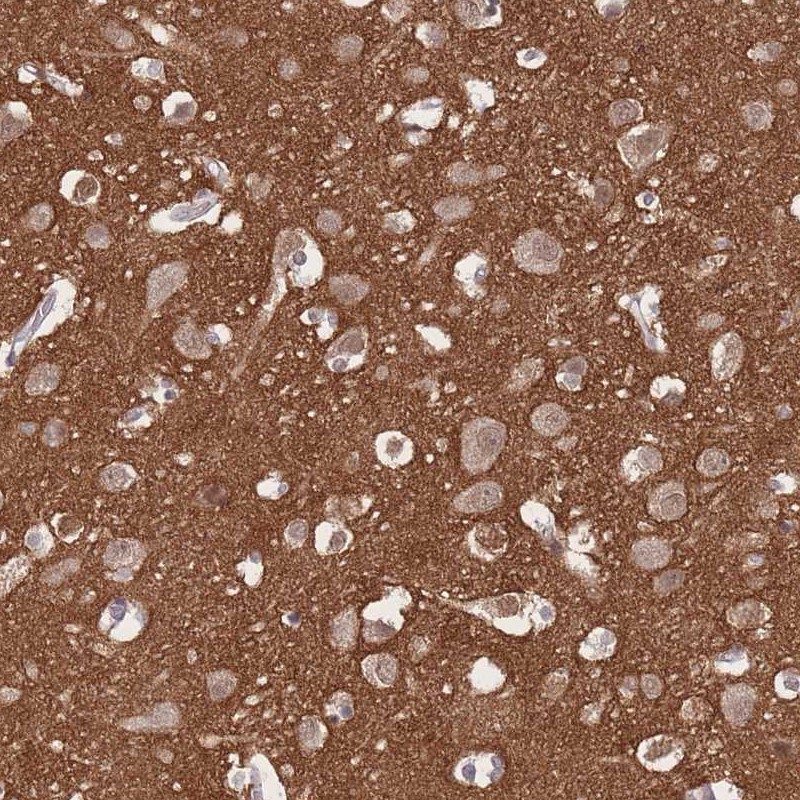 Immunohistochemistry (Formalin/PFA-fixed paraffin-embedded sections) - Anti-Adducin 2 antibody (AB251821), expandable thumbnail