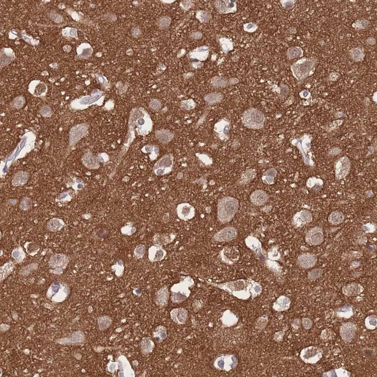 Immunohistochemistry (Formalin/PFA-fixed paraffin-embedded sections) - Anti-Adducin 2 antibody (AB251821)