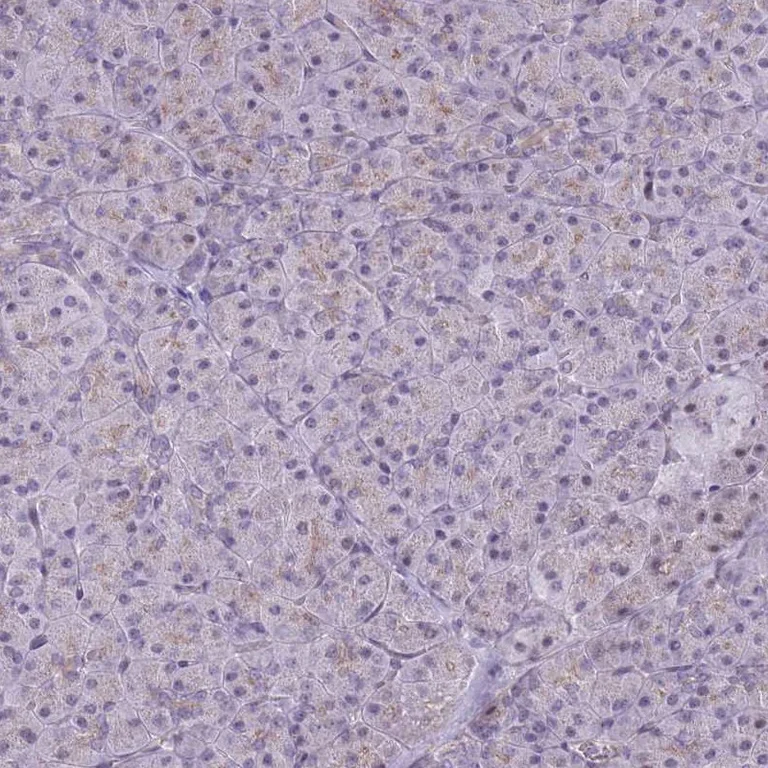 Immunohistochemistry (Formalin/PFA-fixed paraffin-embedded sections) - Anti-Adducin 2 antibody (AB251821)