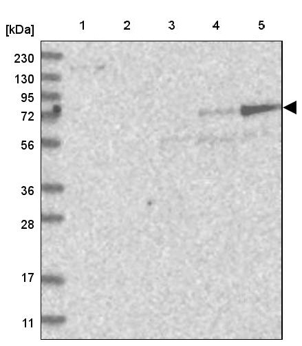 Western blot - Anti-Adducin 2 antibody (AB251821), expandable thumbnail