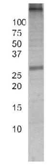 Immunoprecipitation - Adenine Nucleotide Translocase (ANT) Immunocapture Kit (AB109713)