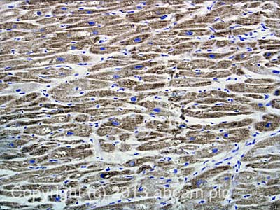 Immunohistochemistry (Formalin/PFA-fixed paraffin-embedded sections) - Anti-Adenine Nucleotide Translocase Immunocapture antibody [5F51BB5AG7] (AB109864), expandable thumbnail