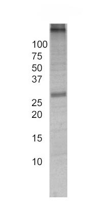 Immunoprecipitation - Anti-Adenine Nucleotide Translocase Immunocapture antibody [5F51BB5AG7] (AB109864), expandable thumbnail