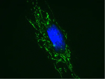 Immunocytochemistry - Anti-Adenine Nucleotide Translocator 1 + 2/ANT 1 + 2 antibody [5F51BB5AG7] (AB290021)