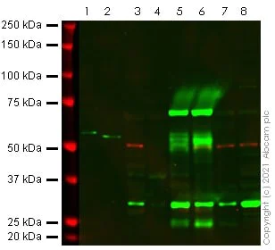 Western blot - Anti-Adenine Nucleotide Translocator 1 + 2/ANT 1 + 2 antibody [5F51BB5AG7] (AB290021)