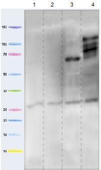Western blot - Anti-Adenine Nucleotide Translocator 1 + 2/ANT 1 + 2 antibody [5F51BB5AG7] (AB290021), expandable thumbnail