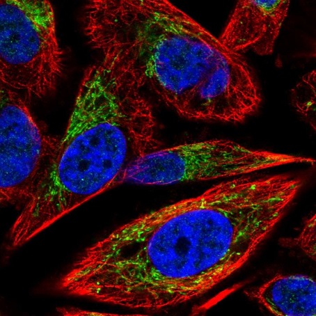 Immunocytochemistry/ Immunofluorescence - Anti-Adenine Nucleotide Translocator 1 + 2/ANT 1 + 2 antibody (AB220408)