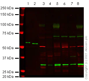 Western blot - Anti-Adenine Nucleotide Translocator 1 + 2/ANT 1 + 2 antibody (AB220408)