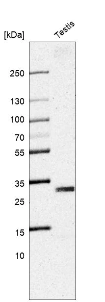 Western blot - Anti-Adenine Nucleotide Translocator 1 + 2/ANT 1 + 2 antibody (AB220408)
