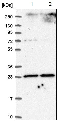 Western blot - Anti-Adenine Nucleotide Translocator 1 + 2/ANT 1 + 2 antibody (AB220408)