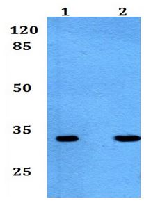 Western blot - Anti-Adenine Nucleotide Translocator 2/ANT 2 antibody (AB192410)