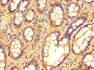 Immunohistochemistry (Formalin/PFA-fixed paraffin-embedded sections) - Anti-Adenine Nucleotide Translocator 2/ANT 2 antibody (AB222843)
