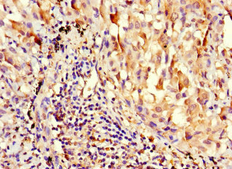 Immunohistochemistry (Formalin/PFA-fixed paraffin-embedded sections) - Anti-Adenine Nucleotide Translocator 2/ANT 2 antibody (AB222843)