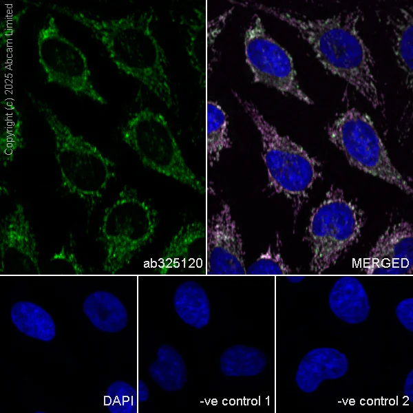Immunocytochemistry/ Immunofluorescence - Anti-Adenine Nucleotide Translocator 2/ANT 2 antibody [EPR29813-534] (AB325120)