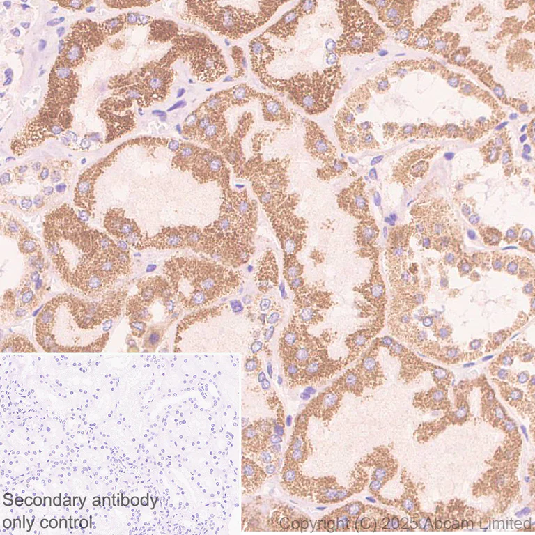 Immunohistochemistry (Formalin/PFA-fixed paraffin-embedded sections) - Anti-Adenine Nucleotide Translocator 2/ANT 2 antibody [EPR29813-534] (AB325120)