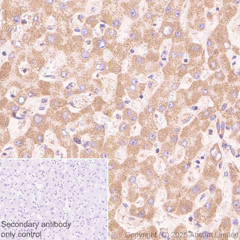 Immunohistochemistry (Formalin/PFA-fixed paraffin-embedded sections) - Anti-Adenine Nucleotide Translocator 2/ANT 2 antibody [EPR29813-534] (AB325120)