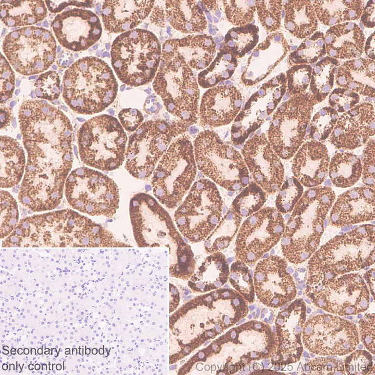 Immunohistochemistry (Formalin/PFA-fixed paraffin-embedded sections) - Anti-Adenine Nucleotide Translocator 2/ANT 2 antibody [EPR29813-534] (AB325120)