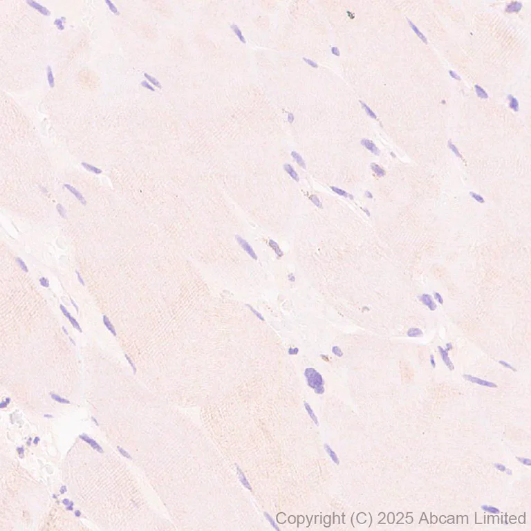 Immunohistochemistry (Formalin/PFA-fixed paraffin-embedded sections) - Anti-Adenine Nucleotide Translocator 2/ANT 2 antibody [EPR29813-534] (AB325120)