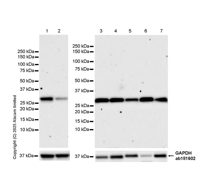 Western blot - Anti-Adenine Nucleotide Translocator 2/ANT 2 antibody [EPR29813-534] (AB325120)