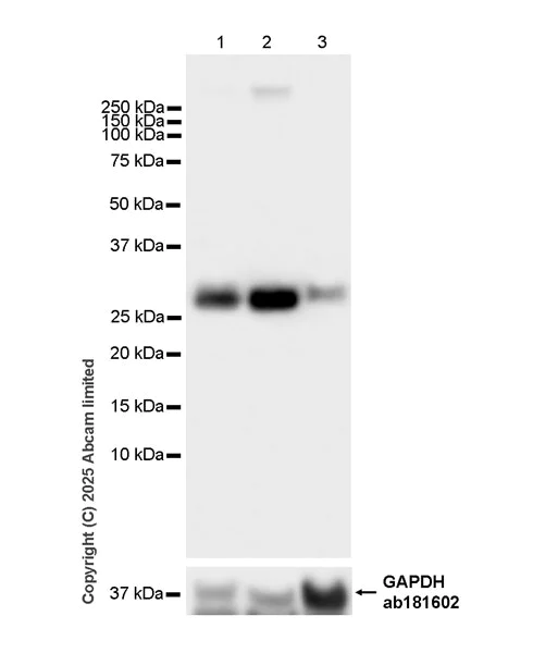 Western blot - Anti-Adenine Nucleotide Translocator 2/ANT 2 antibody [EPR29813-534] (AB325120)