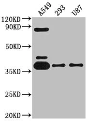 Western blot - Anti-Adenosine A1 Receptor antibody [10D12] (AB288377)