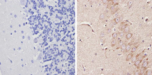 Immunohistochemistry (Formalin/PFA-fixed paraffin-embedded sections) - Anti-Adenosine A1 Receptor antibody (AB3460)