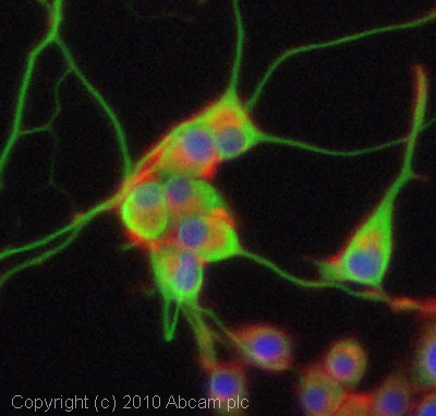 Immunocytochemistry/ Immunofluorescence - Anti-Adenosine A1 Receptor antibody (AB82477)