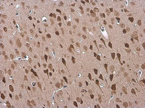 Immunohistochemistry (Formalin/PFA-fixed paraffin-embedded sections) - Anti-Adenosine A2b Receptor/ADORA2B antibody (AB229671)