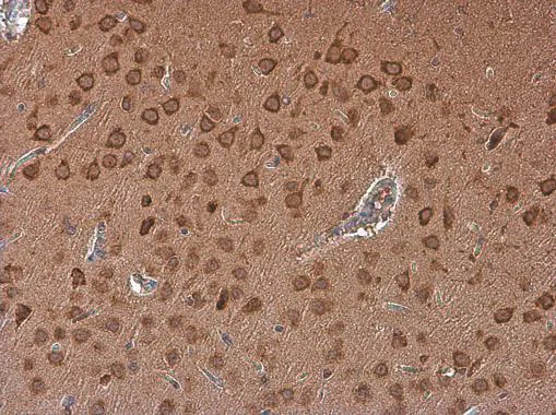 Immunohistochemistry (Formalin/PFA-fixed paraffin-embedded sections) - Anti-Adenosine A2b Receptor/ADORA2B antibody (AB229671)