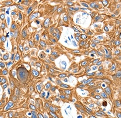 Immunohistochemistry (Formalin/PFA-fixed paraffin-embedded sections) - Anti-Adenosine A3 Receptor/A3AR antibody (AB197350)
